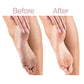 Electric Pedicure Foot File Callus Remover Adeeba's Collection