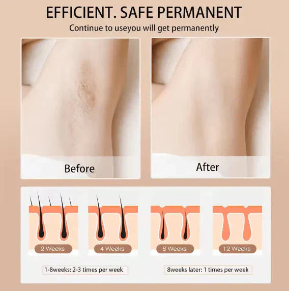 Babyverse - Digital IPL Hair Removal Device GIBBS